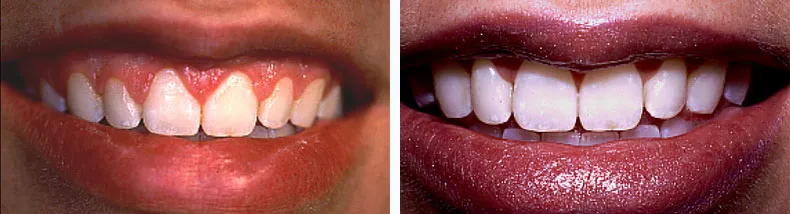 Before & After Case Study 1