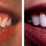 Before & After Case Study 1