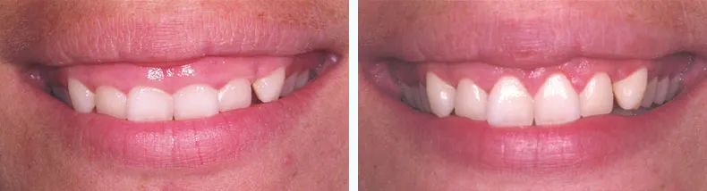 Before & After Case Study 2