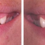 Before & After Case Study 2