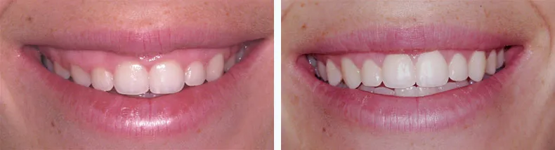 Before & After Case Study 3