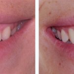 Before & After Case Study 3