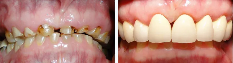 Before & After Case Study 4