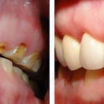 Before & After Case Study 4