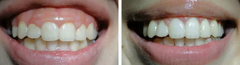 Before & After Case Study 5