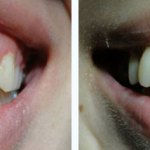 Before & After Case Study 5