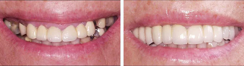 Before & After Case Study 6