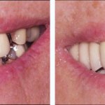 Before & After Case Study 6