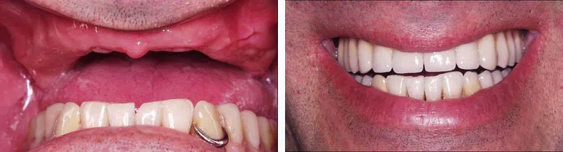 Before & After Case Study 8