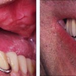 Before & After Case Study 8