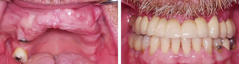 Before & After Case Study 9