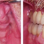 Before & After Case Study 9