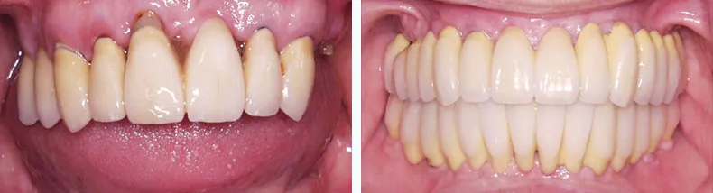 Before & After Case Study 11