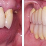 Before & After Case Study 11