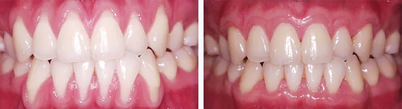 Before & After Case Study 12