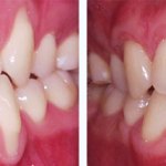 Before & After Case Study 12