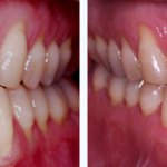 Before & After Case Study 13