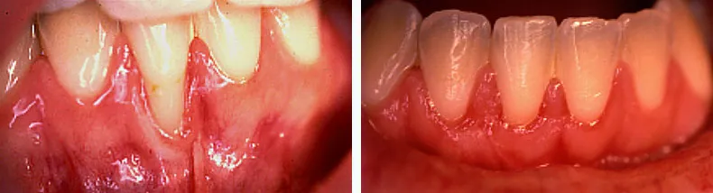 Before & After Case Study 14