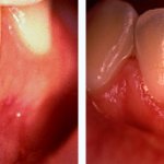 Before & After Case Study 14