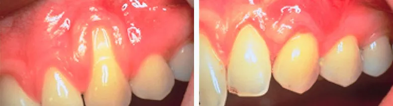 Before & After Case Study 15