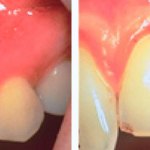 Before & After Case Study 15