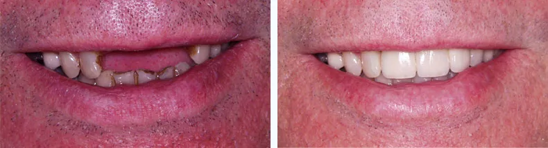 Before & After Case Study 16