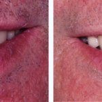 Before & After Case Study 16