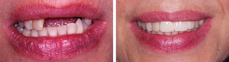 Before & After Case Study 17