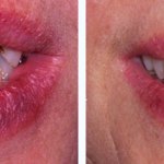 Before & After Case Study 17