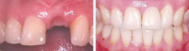 Before & After Case Study 18