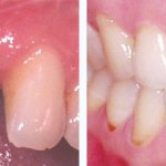 Before & After Case Study 18