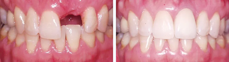 Before & After Case Study 19