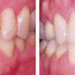 Before & After Case Study 19