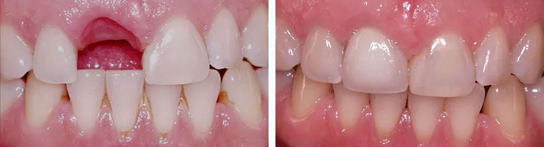 Before & After Case Study 20