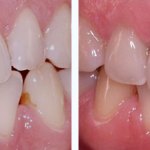 Before & After Case Study 20