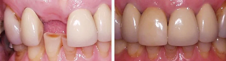 Before & After Case Study 21
