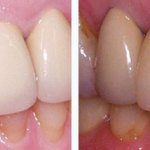 Before & After Case Study 21