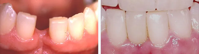 Before & After Case Study 22