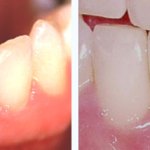 Before & After Case Study 22