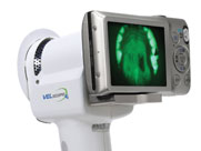 Velscope with Camera-advanced technology at Periodontal Specialists
